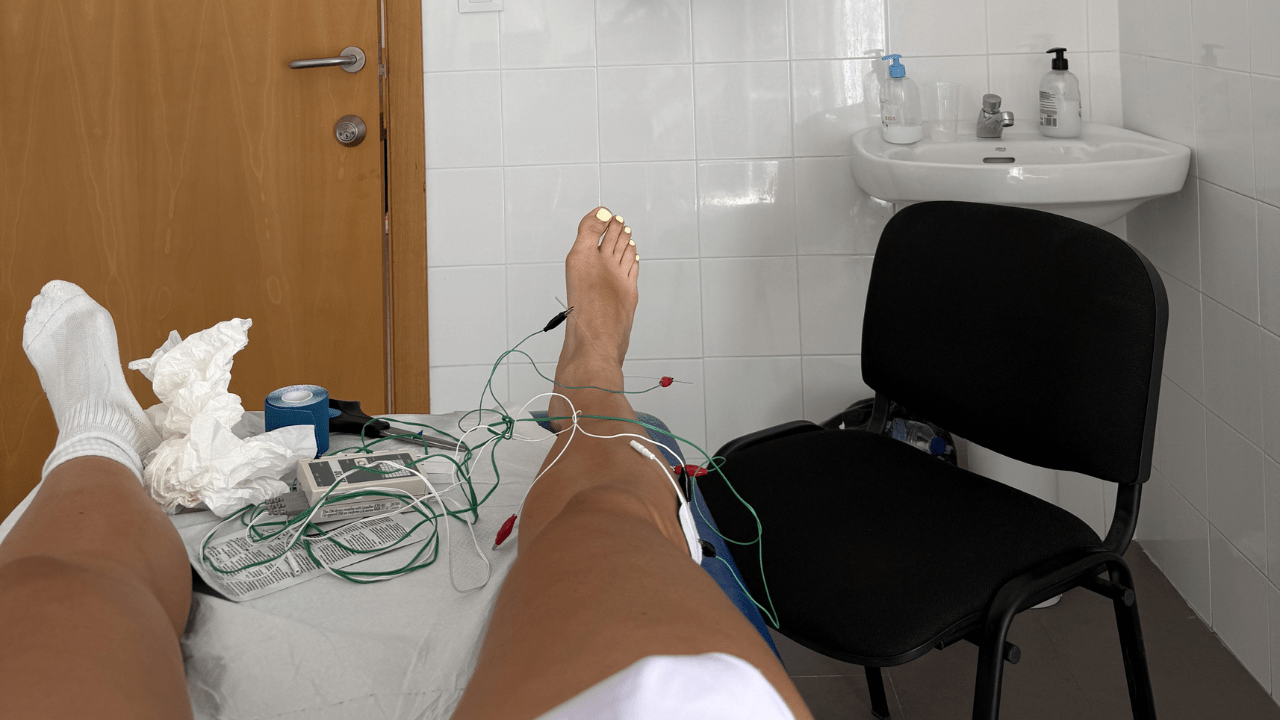 Pickleball ankle injury recovery treatment
